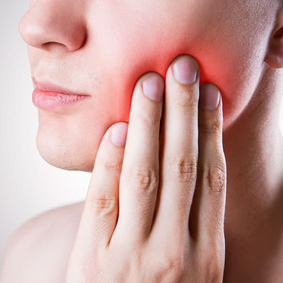 Wisdom Tooth Extraction Sydney