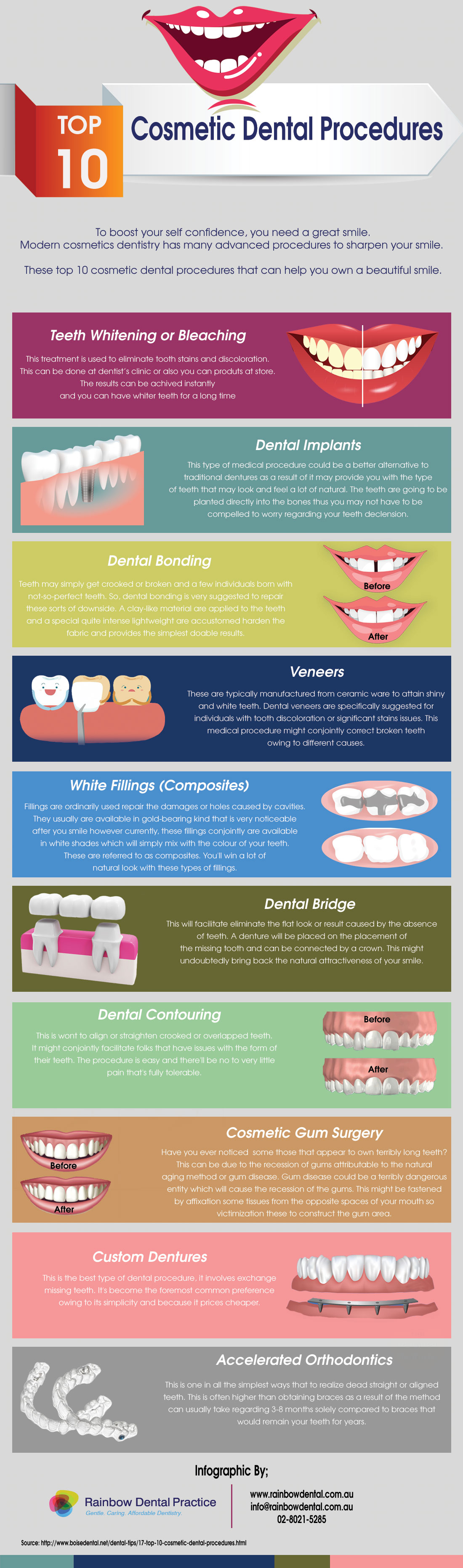 Top 10 Cosmetic Dental Procedures