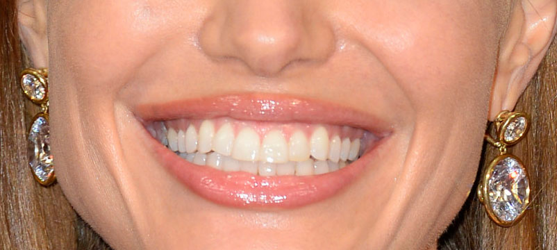 Can you identify these celebrity smiles? | Rainbow Dental